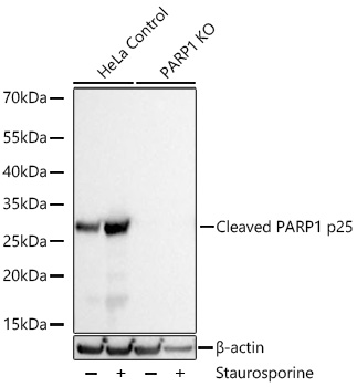 Western blot analysis of lysates from wild type (WT) and Cleaved PARP1 p25 knockout (KO)  cells using Cleaved PARP1 p25 Rabbit mAb at 1:10000  dilution incubated at room temperature for 1.5 hours. Wild type (WT) and PARP1 knockout (KO) HeLa cells were treated with Staurosporine(1 μM)  at 37℃ for 6 hours.|Secondary antibody: HRP-conjugated Goat anti-Rabbit IgG (H+L) at 1:10000 dilution.|Lysates/proteins: 30 μg per lane.|Blocking buffer: 3% nonfat dry milk in TBST.|Detection: ECL Basic Kit.|Exposure time: 1s.