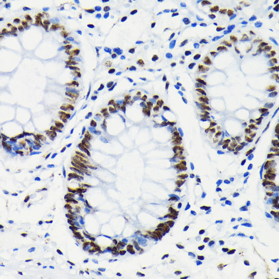 Immunohistochemistry analysis of paraffin-embedded Human colon using Phospho-RB-S780 Rabbit mAb at dilution of 1:100 (40x lens). Microwave antigen retrieval performed with 0.01M Tris/EDTA Buffer (pH 9.0) prior to IHC staining.