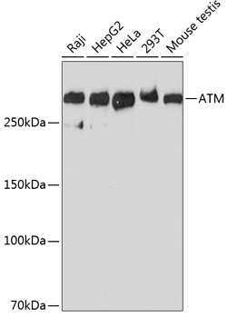 Western blot analysis of various lysates using ATM Rabbit mAb at 1:1000 dilution.|Secondary antibody: HRP-conjugated Goat anti-Rabbit IgG (H+L) at 1:10000 dilution.|Lysates/proteins: 25μg per lane.|Blocking buffer: 3% nonfat dry milk in TBST.|Detection: ECL Basic Kit.|Exposure time: 90s.