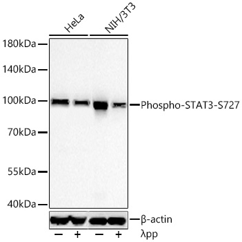 Western blot analysis of various lysates using Phospho-STAT3-S727 Rabbit mAb at 1:10000 dilution incubated overnight at 4℃. HeLa cells and NIH/3T3 cells were treated with λPP (2 U/μL) at 37℃ for 1 hour.|Secondary antibody: HRP-conjugated Goat anti-Rabbit IgG (H+L) at 1:10000 dilution.|Lysates/proteins: 30 μg per lane.|Blocking buffer: 3% nonfat dry milk in TBST.|Detection: ECL Basic Kit.|Exposure time: 45 s.