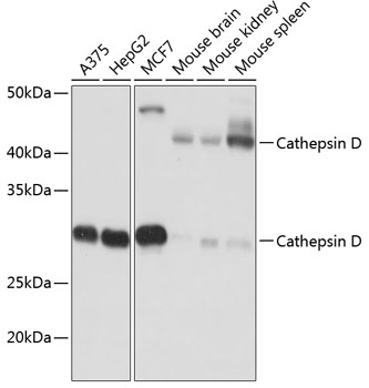Western blot analysis of various lysates using Cathepsin D Rabbit mAb at 1:1000 dilution.|Secondary antibody: HRP-conjugated Goat anti-Rabbit IgG (H+L) at 1:10000 dilution.|Lysates/proteins: 25μg per lane.|Blocking buffer: 3% nonfat dry milk in TBST.|Detection: ECL Basic Kit.|Exposure time: 10s.