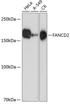Western blot analysis of various lysates using FANCD2 Rabbit mAb at 1:1000 dilution.|Secondary antibody: HRP-conjugated Goat anti-Rabbit IgG (H+L) at 1:10000 dilution.|Lysates/proteins: 25μg per lane.|Blocking buffer: 3% nonfat dry milk in TBST.|Detection: ECL Basic Kit.|Exposure time: 90s.