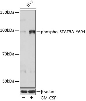 Western blot analysis of lysates from TF-1 cells, using Phospho-STAT5A-Y694 Rabbit mAb at 1:1000 dilution. TF-1 cells were treated with GM-CSF (25 ng/mL) at 37℃ for 30 minutes after serum-starvation overnight.|Secondary antibody: HRP-conjugated Goat anti-Rabbit IgG (H+L) at 1:10000 dilution.|Lysates/proteins: 25μg per lane.|Blocking buffer: 3% nonfat dry milk in TBST.|Detection: ECL Basic Kit.|Exposure time: 60s.