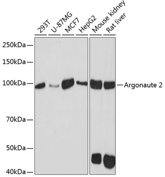 Western blot analysis of various lysates using Argonaute-2 Rabbit mAb at 1:1000 dilution.|Secondary antibody: HRP-conjugated Goat anti-Rabbit IgG (H+L) at 1:10000 dilution.|Lysates/proteins: 25μg per lane.|Blocking buffer: 3% nonfat dry milk in TBST.|Detection: ECL Basic Kit.|Exposure time: 90s.