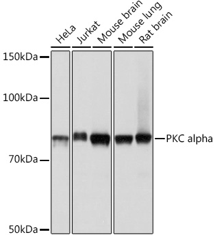 Western blot analysis of various lysates using PKC alpha pAb (A11107) at 1:1000 dilution.|Secondary antibody: HRP-conjugated Goat anti-Rabbit IgG (H+L) (AS014) at 1:10000 dilution.|Lysates/proteins: 25μg per lane.|Blocking buffer: 3% nonfat dry milk in TBST.|Detection: ECL Basic Kit (RM00020).|Exposure time: 1s.