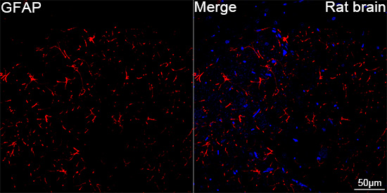 Confocal imaging of paraffin-embedded Rat brain tissue using PSFlo 647 Conjugated GFAP Rabbit mAb. DAPI was used for nuclear staining (Blue). Microwave antigen retrieval performed with 0.01M Citrate Buffer(pH 6.0) prior to IF staining. Objective: 40x.