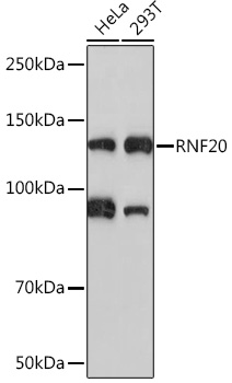 Western blot analysis of various lysates using RNF20 Rabbit mAb at 1:1000 dilution.|Secondary antibody: HRP-conjugated Goat anti-Rabbit IgG (H+L) at 1:10000 dilution.|Lysates/proteins: 25μg per lane.|Blocking buffer: 3% nonfat dry milk in TBST.|Detection: ECL Basic Kit.|Exposure time: 90s.