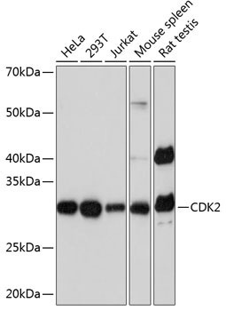 Western blot analysis of various lysates using CDK2 Rabbit mAb (A0094) at 1:1000 dilution.|Secondary antibody: HRP-conjugated Goat anti-Rabbit IgG (H+L) (AS014) at 1:10000 dilution.|Lysates/proteins: 25μg per lane.|Blocking buffer: 3% nonfat dry milk in TBST.|Detection: ECL Basic Kit (RM00020).|Exposure time: 10s.