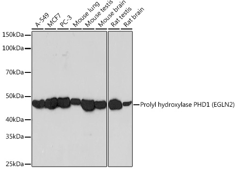 Western blot analysis of various lysates using Prolyl hydroxylase PHD1 (EGLN2) Rabbit mAb at 1:1000 dilution.|Secondary antibody: HRP-conjugated Goat anti-Rabbit IgG (H+L) at 1:10000 dilution.|Lysates/proteins: 25μg per lane.|Blocking buffer: 3% nonfat dry milk in TBST.|Detection: ECL Basic Kit.|Exposure time: 3min.