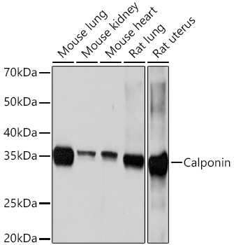 Western blot analysis of various lysates using Calponin Rabbit mAb at 1:1000 dilution.|Secondary antibody: HRP-conjugated Goat anti-Rabbit IgG (H+L) at 1:10000 dilution.|Lysates/proteins: 25μg per lane.|Blocking buffer: 3% nonfat dry milk in TBST.|Detection: ECL Basic Kit.|Exposure time: 10s.