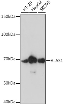 Western blot analysis of various lysates using ALAS1 Rabbit mAb at 1:1000 dilution.|Secondary antibody: HRP-conjugated Goat anti-Rabbit IgG (H+L) at 1:10000 dilution.|Lysates/proteins: 25μg per lane.|Blocking buffer: 3% nonfat dry milk in TBST.|Detection: ECL Enhanced Kit.|Exposure time: 90s.