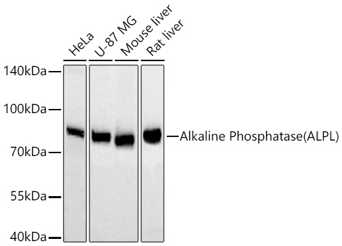 Western blot analysis of various lysates using Alkaline Phosphatase Rabbit mAb at 1:5000 dilution incubated overnight at 4℃.|Secondary antibody: HRP-conjugated Goat anti-Rabbit IgG (H+L) at 1:10000 dilution.|Lysates/proteins: 25 μg per lane.|Blocking buffer: 3% nonfat dry milk in TBST.|Detection: ECL Basic Kit.|Exposure time: 10s.