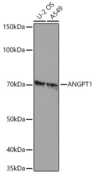 Western blot analysis of various lysates using ANGPT1 Rabbit mAb at 1:1000 dilution incubated overnight at 4℃.|Secondary antibody: HRP-conjugated Goat anti-Rabbit IgG (H+L) at 1:10000 dilution.|Lysates/proteins: 25 μg per lane.|Blocking buffer: 3% nonfat dry milk in TBST.|Detection: ECL Basic Kit.|Exposure time: 3s.