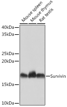 Western blot analysis of various lysates using Survivin Rabbit mAb at 1:1000 dilution.|Secondary antibody: HRP-conjugated Goat anti-Rabbit IgG (H+L) at 1:10000 dilution.|Lysates/proteins: 25μg per lane.|Blocking buffer: 3% nonfat dry milk in TBST.|Detection: ECL Basic Kit.|Exposure time: 1min.