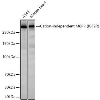 Western blot analysis of various lysates using Cation-independent M6PR (IGF2R) Rabbit mAb at 1:3000 dilution incubated at room temperature for 1.5 hours.|Secondary antibody: HRP-conjugated Goat anti-Rabbit IgG (H+L) at 1:10000 dilution.|Lysates/proteins: 25 μg per lane.|Blocking buffer: 3% nonfat dry milk in TBST.|Detection: ECL Basic Kit.|Exposure time: 20 s.