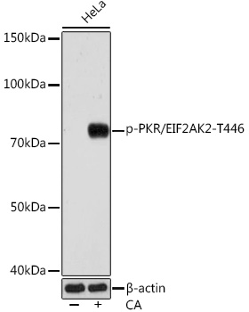 Western blot analysis of lysates from HeLa cells, using Phospho-PKR/EIF2AK2-T446 Rabbit mAb at 1:1000 dilution. HeLa cells were treated with Calyculin A (100 nM) at 37℃ for 30 minutes after serum-starvation overnight.|Secondary antibody: HRP-conjugated Goat anti-Rabbit IgG (H+L) at 1:10000 dilution.|Lysates/proteins: 25μg per lane.|Blocking buffer: 3% BSA.|Detection: ECL Basic Kit.|Exposure time: 3min.