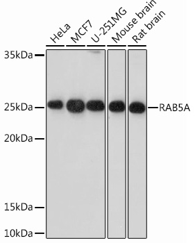 Western blot analysis of various lysates using RAB5AA Rabbit mAb at 1：1000 dilution.|Secondary antibody: HRP-conjugated Goat anti-Rabbit IgG (H+L) at 1:10000 dilution.|Lysates/proteins: 25μg per lane.|Blocking buffer: 3% nonfat dry milk in TBST.|Detection: ECL Basic Kit.|Exposure time: 30s.