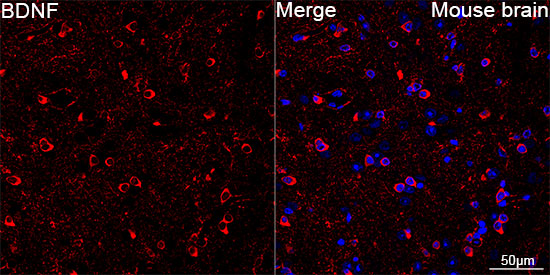 Confocal imaging of paraffin-embedded Mouse brain  using BDNF Rabbit mAb  followed by a further incubation with Cy3 Goat Anti-Rabbit IgG (H+L)(Red).DAPI was used for nuclear staining (Blue). Objective: 40x. Perform microwave antigen retrieval with 0.01 M citRate buffer (pH 6.0) prior to IF staining.