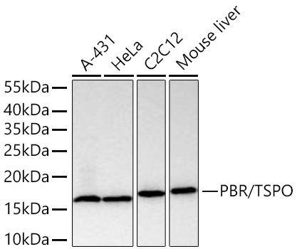Western blot analysis of various lysates using PBR/TSPO Rabbit mAb at 1:5000 dilution incubated overnight at 4℃.|Secondary antibody: HRP-conjugated Goat anti-Rabbit IgG (H+L) at 1:10000 dilution.|Lysates/proteins: 25 μg per lane.|Blocking buffer: 3% nonfat dry milk in TBST.|Detection: ECL Basic Kit.|Exposure time: 1s.