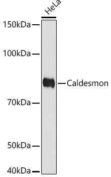 Western blot analysis of lysates from HeLa cells, using Caldesmon Rabbit mAb at 1:1000 dilution.|Secondary antibody: HRP-conjugated Goat anti-Rabbit IgG (H+L) at 1:10000 dilution.|Lysates/proteins: 25μg per lane.|Blocking buffer: 3% nonfat dry milk in TBST.|Detection: ECL Basic Kit.|Exposure time: 90s.