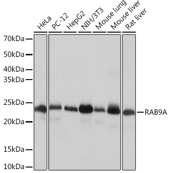 Western blot analysis of various lysates using RAB9A Rabbit mAb at 1:1000 dilution.|Secondary antibody: HRP-conjugated Goat anti-Rabbit IgG (H+L) at 1:10000 dilution.|Lysates/proteins: 25μg per lane.|Blocking buffer: 3% nonfat dry milk in TBST.|Detection: ECL Basic Kit.|Exposure time: 1s.