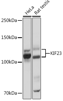 Western blot analysis of various lysates using KIF23 Rabbit mAb at 1:1000 dilution.|Secondary antibody: HRP-conjugated Goat anti-Rabbit IgG (H+L) at 1:10000 dilution.|Lysates/proteins: 25μg per lane.|Blocking buffer: 3% nonfat dry milk in TBST.|Detection: ECL Basic Kit.|Exposure time: 10s.