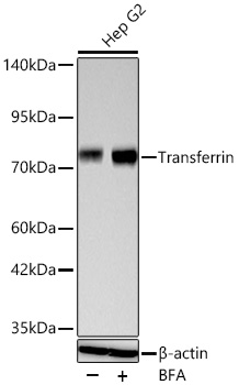 Western blot analysis of lysates from Hep G2 cells using Transferrin Rabbit mAb (A19130) at 1:1000 dilution incubated overnight at 4℃. Hep G2 cells were treated with BFA (30 ng/mL) at 37℃ for 1.5 hours.|Secondary antibody: HRP-conjugated Goat anti-Rabbit IgG (H+L) (AS014) at 1:10000 dilution.|Lysates/proteins: 30 μg per lane.| Blocking buffer: 3 % nonfat dry milk in TBST.| Detection: ECL Basic Kit (RM00020).| Exposure time: 180s.