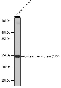 Western blot analysis of lysates from Human serum, using C-Reactive Protein (CRP) Rabbit mAb at 1:1000 dilution.|Secondary antibody: HRP-conjugated Goat anti-Rabbit IgG (H+L) at 1:10000 dilution.|Lysates/proteins: 25μg per lane.|Blocking buffer: 3% nonfat dry milk in TBST.|Detection: ECL Basic Kit.|Exposure time: 5s.