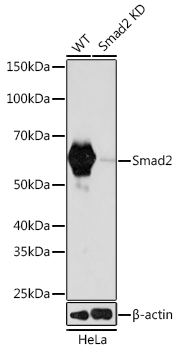 Western blot analysis of lysates from wild type (WT) and Smad2 knockdown (KD) HeLa cells using [KD Validated] Smad2 Rabbit mAb (A19114) at 1:1000 dilution incubated overnight at 4℃.|Secondary antibody: HRP-conjugated Goat anti-Rabbit IgG (H+L) (AS014) at 1:10000 dilution.|Lysates/proteins: 25μg per lane.|Blocking buffer: 3% nonfat dry milk in TBST.|Detection: ECL Basic Kit (RM00020).|Exposure time: 60s.