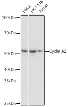 Western blot analysis of various lysates using Cyclin A2 Rabbit mAb at 1:1000 dilution.|Secondary antibody: HRP-conjugated Goat anti-Rabbit IgG (H+L) at 1:10000 dilution.|Lysates/proteins: 25μg per lane.|Blocking buffer: 3% nonfat dry milk in TBST.|Detection: ECL Basic Kit.|Exposure time: 1s.