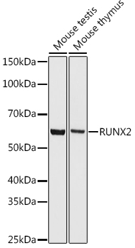 Western blot analysis of various lysates using RUNX2 Rabbit mAb at 1:500 dilution.|Secondary antibody: HRP-conjugated Goat anti-Rabbit IgG (H+L) at 1:10000 dilution.|Lysates/proteins: 25μg per lane.|Blocking buffer: 3% nonfat dry milk in TBST.|Detection: ECL Basic Kit.|Exposure time: 10s.