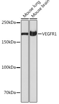 Western blot analysis of various lysates using VEGFR1 Rabbit mAb (A19132) at 1:1000 dilution.|Secondary antibody: HRP-conjugated Goat anti-Rabbit IgG (H+L) (AS014) at 1:10000 dilution.|Lysates/proteins: 25μg per lane.|Blocking buffer: 3% nonfat dry milk in TBST.|Detection: ECL Basic Kit (RM00020).|Exposure time: 1s.
