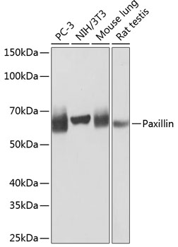 Western blot analysis of various lysates using Paxillin Rabbit mAb at 1:1000 dilution.|Secondary antibody: HRP-conjugated Goat anti-Rabbit IgG (H+L) at 1:10000 dilution.|Lysates/proteins: 25μg per lane.|Blocking buffer: 3% nonfat dry milk in TBST.|Detection: ECL Basic Kit.|Exposure time: 1s.