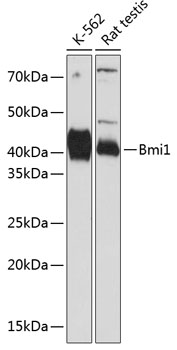 Western blot analysis of various lysates using Bmi1 Rabbit mAb at 1:1000 dilution.|Secondary antibody: HRP-conjugated Goat anti-Rabbit IgG (H+L) at 1:10000 dilution.|Lysates/proteins: 25μg per lane.|Blocking buffer: 3% nonfat dry milk in TBST.|Detection: ECL Basic Kit.|Exposure time: 60s.