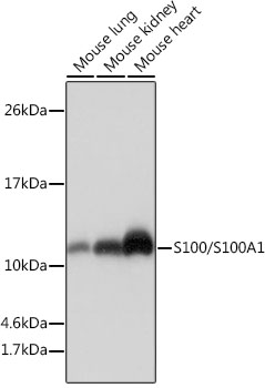 Western blot analysis of various lysates using S100/S100A1 Rabbit mAb at 1:1000 dilution.|Secondary antibody: HRP-conjugated Goat anti-Rabbit IgG (H+L) at 1:10000 dilution.|Lysates/proteins: 25μg per lane.|Blocking buffer: 3% nonfat dry milk in TBST.|Detection: ECL Basic Kit.|Exposure time: 1s.