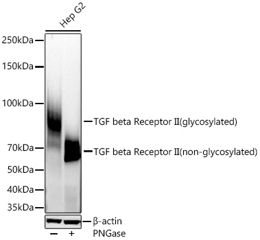 Western blot analysis of lysates from Hep G2 cells using TGF beta Receptor II Rabbit mAb (A19124) at 1:9000 dilution incubated overnight at 4℃. Hep G2 cells were treated by PNGase(1 μL) at 37℃ for 30 minutes.|Secondary antibody: HRP-conjugated Goat anti-Rabbit IgG (H+L) (AS014) at 1:10000 dilution.|Lysates/proteins: 30 μg per lane.| Blocking buffer: 3 % nonfat dry milk in TBST.| Detection: ECL Basic Kit (RM00020).| Exposure time: 45s.