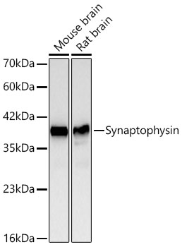 Western blot analysis of various lysates using Synaptophysin Rabbit mAb at 1:1000 dilution.|Secondary antibody: HRP-conjugated Goat anti-Rabbit IgG (H+L) at 1:10000 dilution.|Lysates/proteins: 25μg per lane.|Blocking buffer: 3% nonfat dry milk in TBST.|Detection: ECL Basic Kit.|Exposure time: 60s.