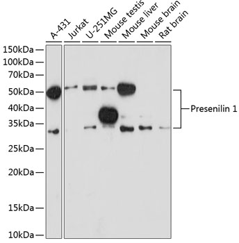 Western blot analysis of various lysates using Presenilin 1 Rabbit mAb at 1:1000 dilution.|Secondary antibody: HRP-conjugated Goat anti-Rabbit IgG (H+L) at 1:10000 dilution.|Lysates/proteins: 25μg per lane.|Blocking buffer: 3% nonfat dry milk in TBST.|Detection: ECL Enhanced Kit.|Exposure time: 180 s.