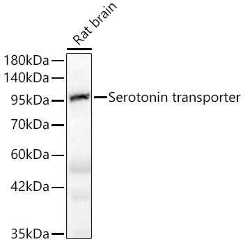 Western blot analysis of rat brain using Serotonin transporter Rabbit mAb at  1:1000 dilution.|Secondary antibody: HRP-conjugated Goat anti-Rabbit IgG (H+L) at 1:10000 dilution.|Lysates/proteins: 25μg per lane.|Blocking buffer: 3% nonfat dry milk in TBST.|Detection: ECL Basic Kit.|Exposure time: 5s.
