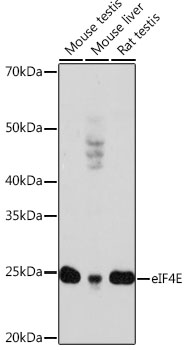 Western blot analysis of various lysates using eIF4E Rabbit mAb at 1:1000 dilution.|Secondary antibody: HRP-conjugated Goat anti-Rabbit IgG (H+L) at 1:10000 dilution.|Lysates/proteins: 25μg per lane.|Blocking buffer: 3% nonfat dry milk in TBST.|Detection: ECL Enhanced Kit.|Exposure time: 3min.
