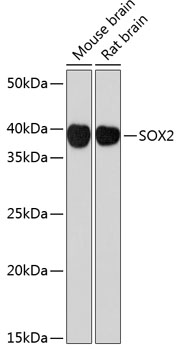Western blot analysis of various lysates using SOX2 Rabbit mAb at 1:1000 dilution.|Secondary antibody: HRP-conjugated Goat anti-Rabbit IgG (H+L) at 1:10000 dilution.|Lysates/proteins: 25μg per lane.|Blocking buffer: 3% nonfat dry milk in TBST.|Detection: ECL Basic Kit.|Exposure time: 90s.