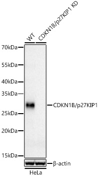 Western blot analysis of lysates from wild type (WT) and CDKN1B/p27KIP1 knockdown (KD) HeLa cells using [KO Validated] CDKN1B/p27KIP1 Rabbit mAb (A19095) at 1:5000 dilution incubated overnight at 4℃.|Secondary antibody: HRP-conjugated Goat anti-Rabbit IgG (H+L) (AS014) at 1:10000 dilution.|Lysates/proteins: 25 μg per lane.|Blocking buffer: 3% nonfat dry milk in TBST.|Detection: ECL Basic Kit (RM00020).|Exposure time: 60 s.