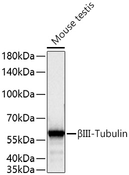 Western blot analysis of lysates from Mouse testis using βIII-Tubulin Rabbit mAb (A17913) at 1:200000 dilution incubated overnight at 4℃.|Secondary antibody: HRP-conjugated Goat anti-Rabbit IgG (H+L) (AS014) at 1:10000 dilution.|Lysates/proteins: 25 μg per lane.|Blocking buffer: 3% nonfat dry milk in TBST.|Detection: ECL Basic Kit (RM00020).|Exposure time: 1 s.