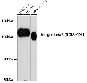 Western blot analysis of various lysates using Integrin beta 3 (ITGB3/CD61) Rabbit mAb at 1:1000 dilution.|Secondary antibody: HRP-conjugated Goat anti-Rabbit IgG (H+L) at 1:10000 dilution.|Lysates/proteins: 25μg per lane.|Blocking buffer: 3% nonfat dry milk in TBST.|Detection: ECL Basic Kit.|Exposure time: 90s.