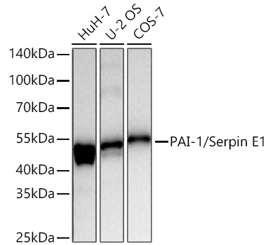 Western blot analysis of various lysates using PAI-1/Serpin E1 Rabbit mAb at 1:1000 dilution incubated overnight at 4℃.|Secondary antibody: HRP-conjugated Goat anti-Rabbit IgG (H+L) at 1:10000 dilution.|Lysates/proteins: 25 μg per lane.|Blocking buffer: 3% nonfat dry milk in TBST.|Detection: ECL Basic Kit.|Exposure time: 45s.