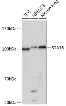 Western blot analysis of various lysates using STAT6 Rabbit mAb at 1:1000 dilution.|Secondary antibody: HRP-conjugated Goat anti-Rabbit IgG (H+L) at 1:10000 dilution.|Lysates/proteins: 25μg per lane.|Blocking buffer: 3% nonfat dry milk in TBST.|Detection: ECL Basic Kit.|Exposure time: 3min.