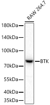 Western blot analysis of lysates from RAW 264.7 cells using BTK Rabbit mAb at 1:1000 dilution incubated at room temperature for 1.5 hours.|Secondary antibody: HRP-conjugated Goat anti-Rabbit IgG (H+L) at 1:10000 dilution.|Lysates/proteins: 25 μg per lane.|Blocking buffer: 3% nonfat dry milk in TBST.|Detection: ECL Basic Kit.|Exposure time: 90 s.