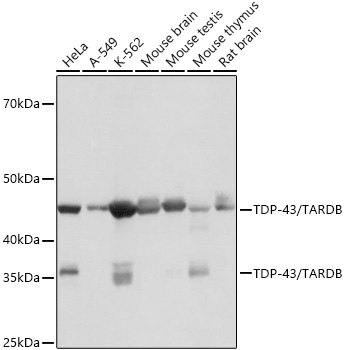 Western blot analysis of various lysates using TDP-43/TARDBP Rabbit mAb (A19123) at 1:1000 dilution.|Secondary antibody: HRP-conjugated Goat anti-Rabbit IgG (H+L) (AS014) at 1:10000 dilution.|Lysates/proteins: 25μg per lane.|Blocking buffer: 3% nonfat dry milk in TBST.|Detection: ECL Basic Kit (RM00020).|Exposure time: 10s.