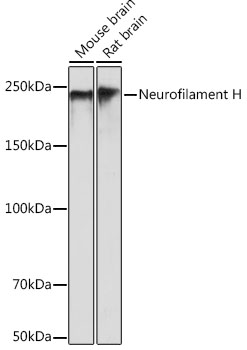 Western blot analysis of various lysates using Neurofilament H Rabbit mAb at 1:500 dilution.|Secondary antibody: HRP-conjugated Goat anti-Rabbit IgG (H+L) at 1:10000 dilution.|Lysates/proteins: 25μg per lane.|Blocking buffer: 3% nonfat dry milk in TBST.|Detection: ECL Basic Kit.|Exposure time: 1s.