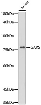Western blot analysis of lysates from Jurkat cells, using [KO Validated] GARS Rabbit mAb (A0651) at  1:1000 dilution.|Secondary antibody: HRP-conjugated Goat anti-Rabbit IgG (H+L) (AS014) at 1:10000 dilution.|Lysates/proteins: 25μg per lane.|Blocking buffer: 3% nonfat dry milk in TBST.|Detection: ECL Basic Kit (RM00020).|Exposure time: 180s.